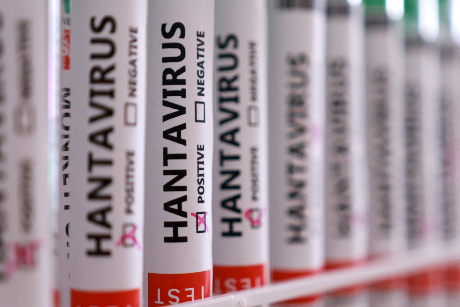 Türkiye'de hantavirüs vakası var mı? Sağlık Bakanlığı'ndan açıklama